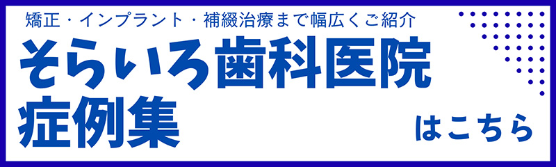 そらいろ歯科医院症例集はこちら